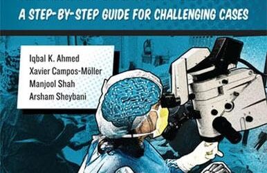 Illustrated Advanced Anterior Segment Surgery A Step-by-Step Guide for Challenging Cases 1st Edition