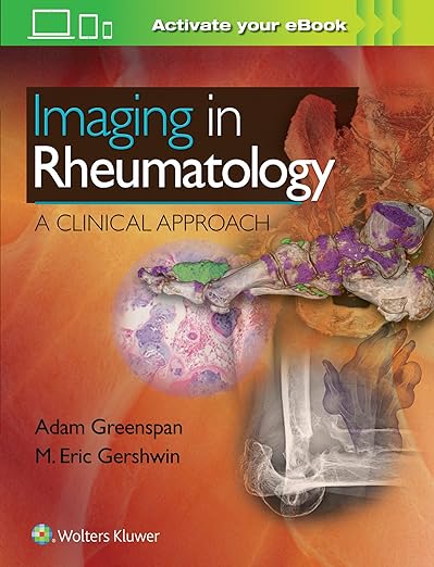 Bildgebung in der Rheumatologie: Ein klinischer Ansatz, 1. Auflage