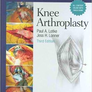 Master Techniques in Orthopaedic Surgery – Knee Arthroplasty, 3rd Edition