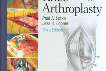 Master Techniques in Orthopaedic Surgery – Knee Arthroplasty, 3rd Edition
