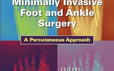 Minimally Invasive Foot and Ankle Surgery A Percutaneous Approach First Edition