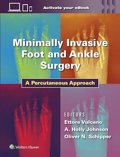 Minimalinvasive Fuß- und Sprunggelenkschirurgie – Ein perkutaner Ansatz Erste Auflage