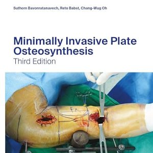 Minimally Invasive Plate Osteosynthesis (AO-Publishing) 3rd edition