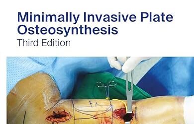 Minimally Invasive Plate Osteosynthesis (AO-Publishing) 3rd edition