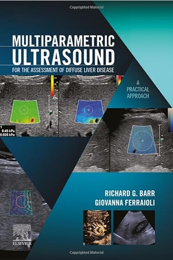 Ultrasonografia wieloparametryczna do oceny rozsianej choroby wątroby – podejście praktyczne, wydanie 1