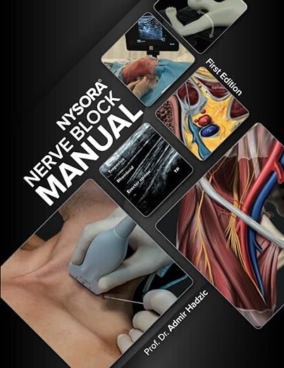 NYSORA Nerve Block Manual (Hadzic)
