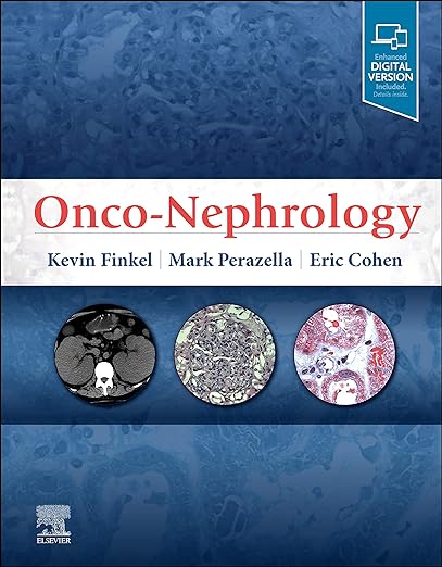 Onco-Nefrología 1ª Edición