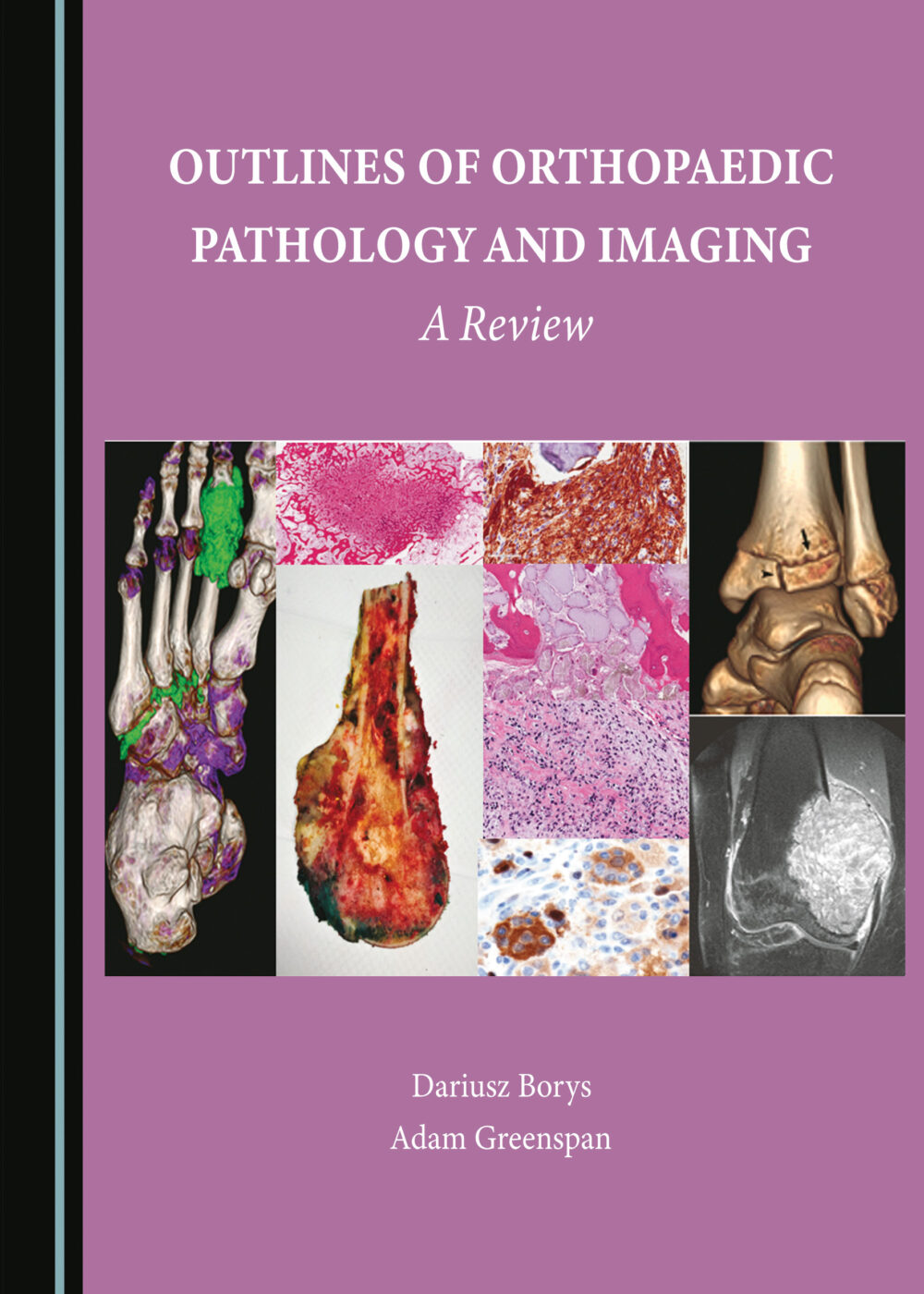 Outlines of Orthopaedic Pathology and Imaging A Review