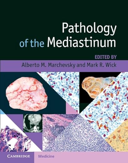 Patologia do Mediastino 1ª Edição