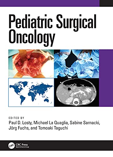 Oncologia Cirúrgica Pediátrica