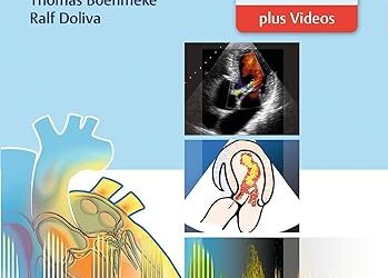 Pocket Atlas of Echocardiography 2nd Edition