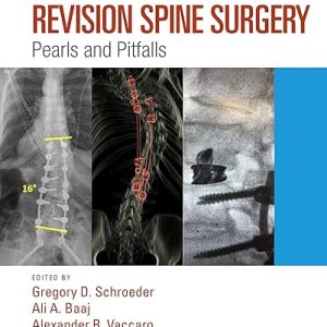 Revision Spine Surgery Pearls and Pitfalls 1st Edition