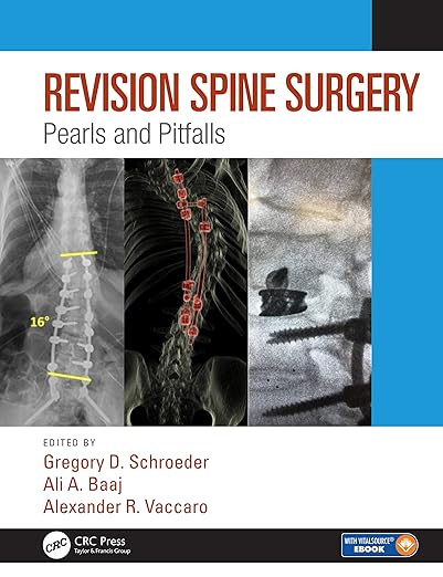 Revision Spine Surgery Pearls and Pitfalls 1st Edition
