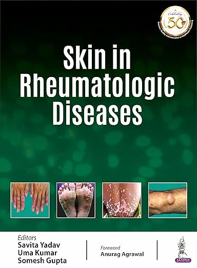 الجلد في أمراض الروماتيزم - الطبعة الأولى