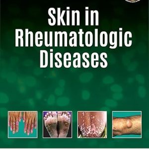 Skin in Rheumatologic Diseases – 1st edition