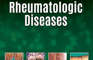 Skin in Rheumatologic Diseases – 1st edition
