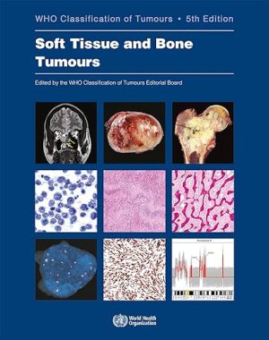 Soft Tissue and Bone Tumours WHO Classification of Tumours (Medicine) 5th Edition