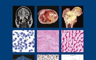 Soft Tissue and Bone Tumours WHO Classification of Tumours (Medicine) 5th Edition