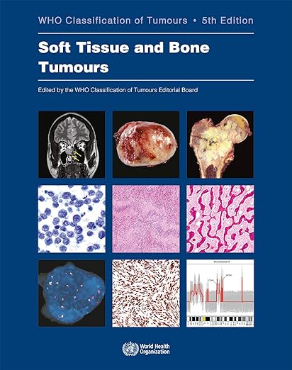 Tumores de Tecidos Moles e Ósseos Classificação de Tumores da OMS (Medicina) 5ª Edição