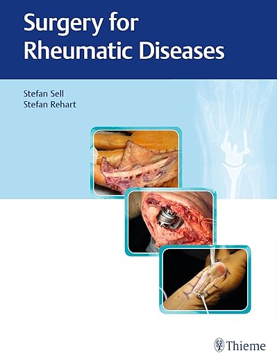 Surgery for Rheumatic Diseases Illustrated Edition