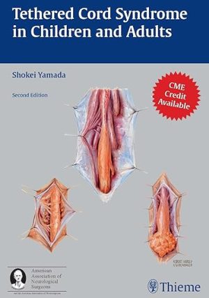 Tethered Cord Syndrome in Children and Adults 2nd Edition