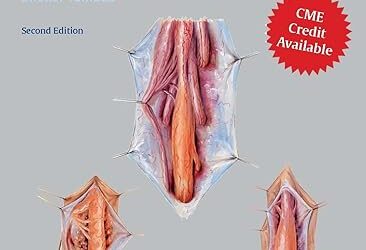 Tethered Cord Syndrome in Children and Adults 2nd Edition