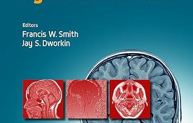 The Craniocervical Syndrome and MRI 1st Edition