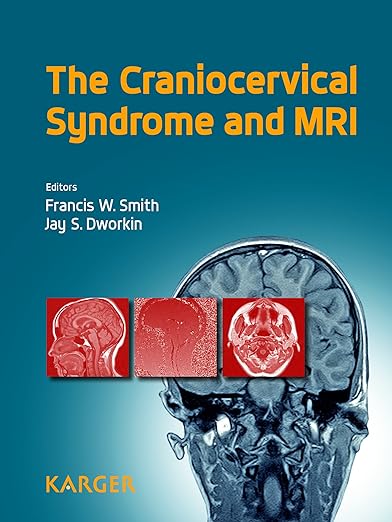 頭蓋頸部症候群と MRI 第 1 版