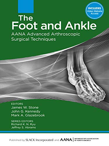 Techniques chirurgicales arthroscopiques avancées AANA du pied et de la cheville