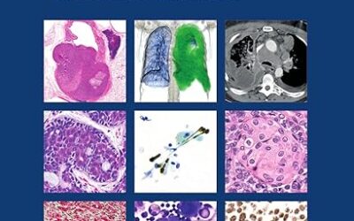 Thoracic Tumours WHO Classification of Tumours 5th Edition