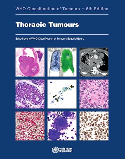 Thoracic Tumours WHO Classification of Tumours 5th Edition