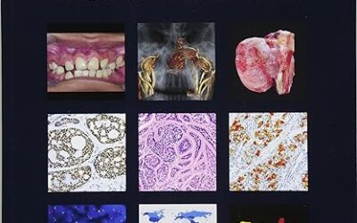 WHO Classification of Head and Neck Tumours (WHO Classification of Tumours) 4th Edition