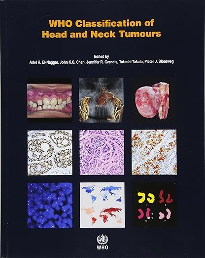 WHO Classification of Head and Neck Tumours (WHO Classification of Tumours) 4th Edition