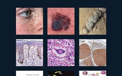 WHO Classification of Skin Tumours (WHO Classification of Tumours) 4th Edition