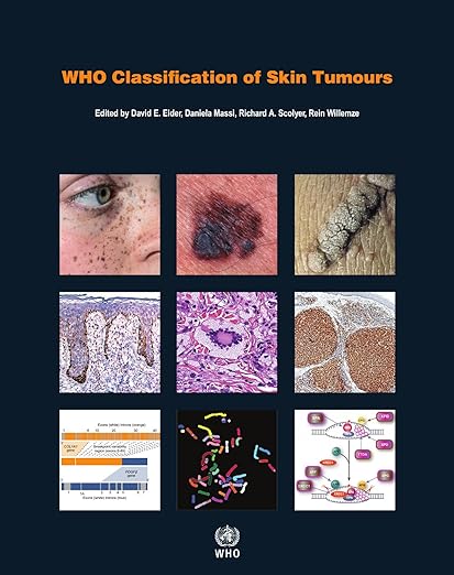 Classificação de Tumores de Pele da OMS (Classificação de Tumores da OMS) 4ª Edição
