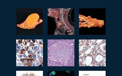 WHO Classification of Tumours of Endocrine Organs 4th Edition
