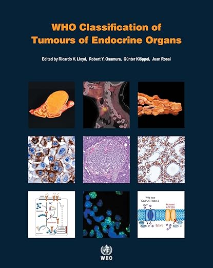 Classificação da OMS de Tumores de Órgãos Endócrinos 4ª Edição