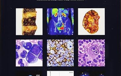 WHO Classification of Tumours of Haematopoietic and Lymphoid Tissues Revised Fourth Edition