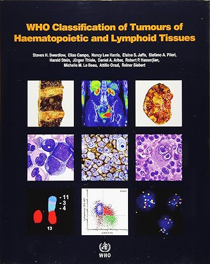 Clasificación OMS de tumores de tejidos hematopoyéticos y linfoides revisada cuarta edición