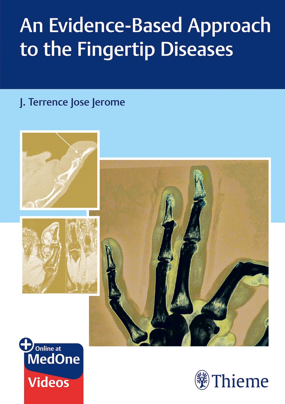 An Evidence-Based Approach to the Fingertip Diseases 1st Edition
