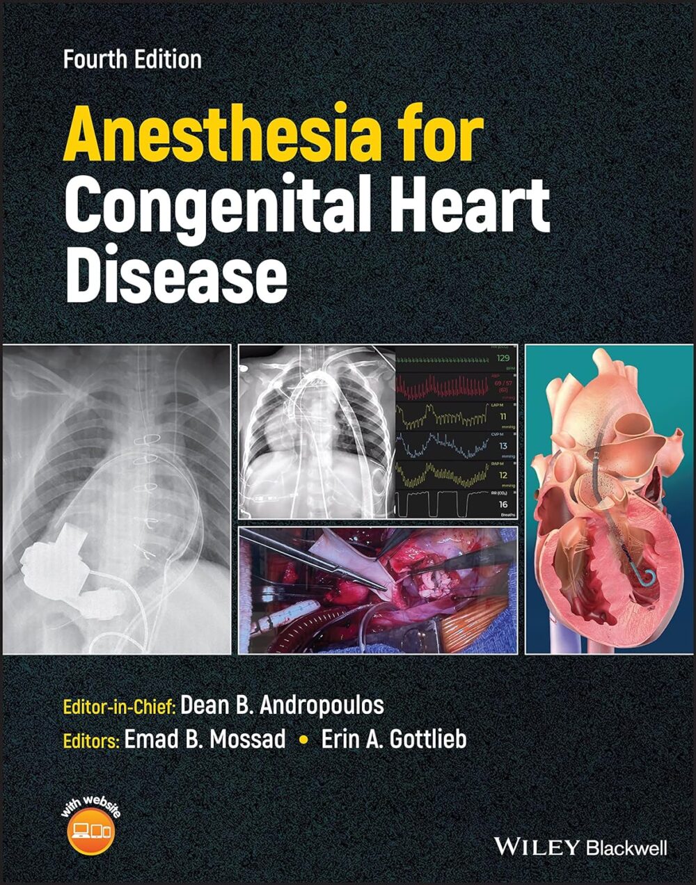 Anesthesia for Congenital Heart Disease 4th Edition PDF
