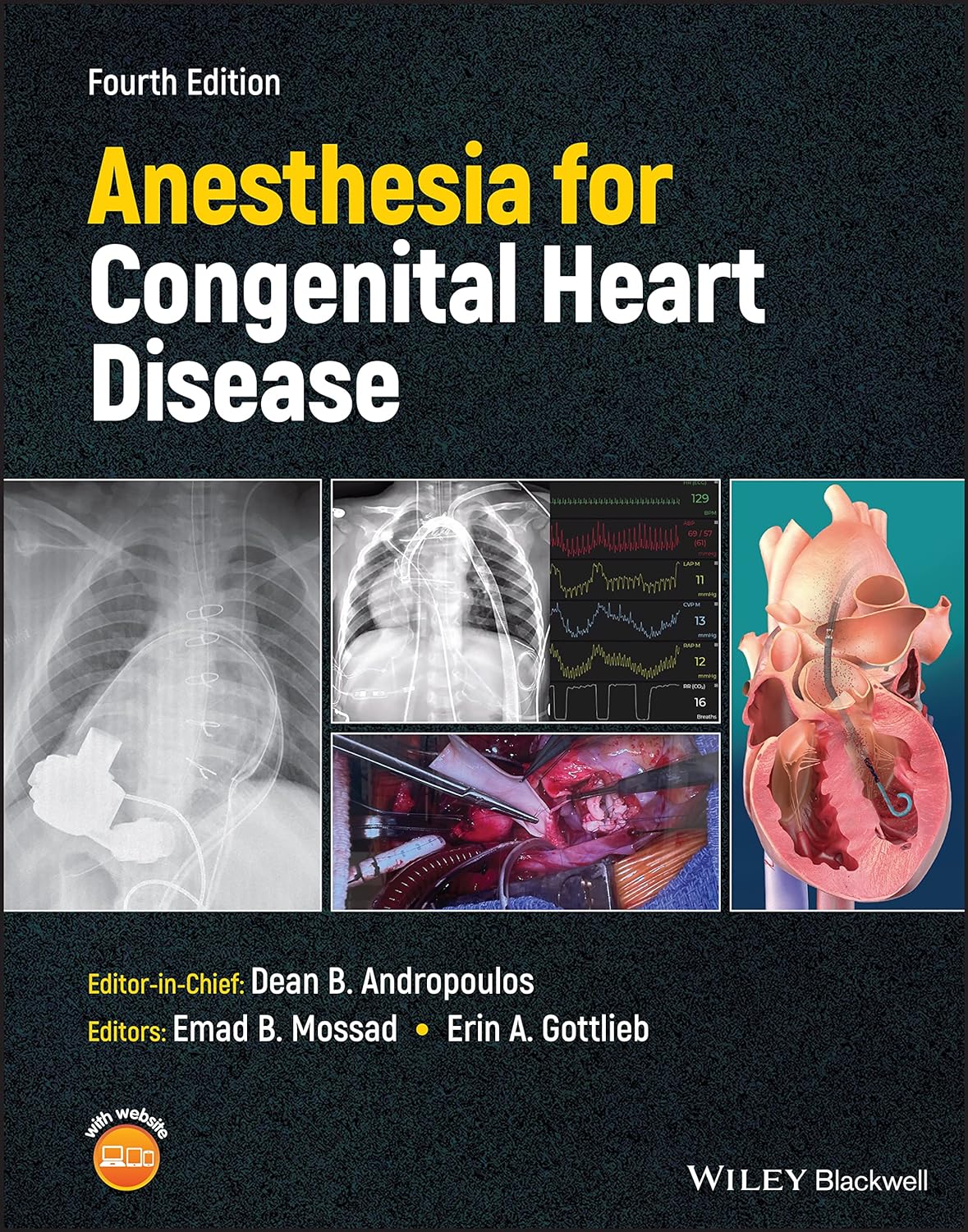 Anesthesia for Congenital Heart Disease 4th Edition (EPUB)