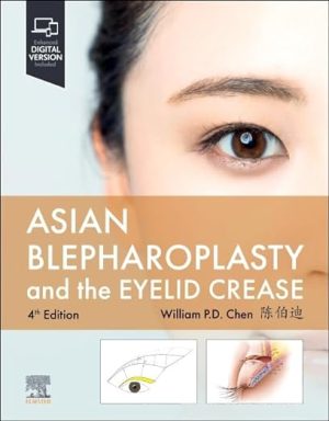 Asian Blepharoplasty and the Eyelid Crease 4th Edition