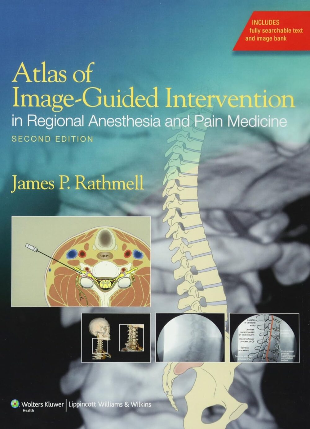Atlas de intervenção guiada por imagem em anestesia regional e medicina da dor, segunda edição