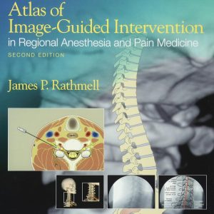 Atlas of Image-Guided Intervention in Regional Anesthesia and Pain Medicine Second Edition