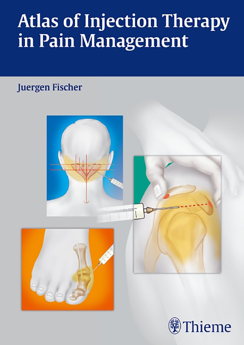 Atlas of Injection Therapy in Pain Management 1st Edition