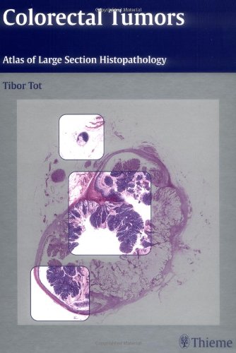 Atlante dei tumori colorettali di istopatologia di grandi sezioni 1a edizione