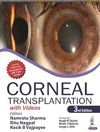 Transplantation cornéenne 3e édition