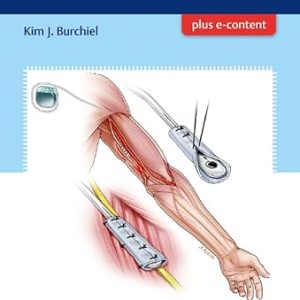 Handbook of Pain Surgery 1st Edition