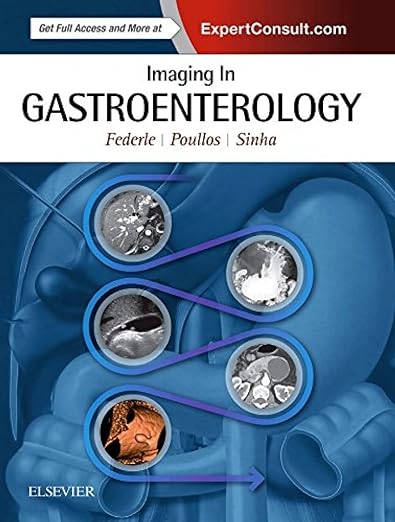 Ukufanekisa ku-Gastroenterology 1st Edition
